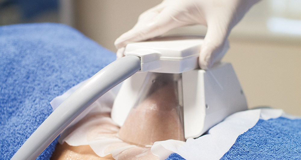 How Fat Freezing and HIFU Work Together? 2 Multiple Areas in One Session HIFU and Fat Freezing Wickford