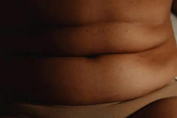 The Hidden Connection: How Stress Shapes Your Fitness and Body Composition 3 image of what stress can do on the stomach area and how Lipo 360 Wickford can help to change your body shape.