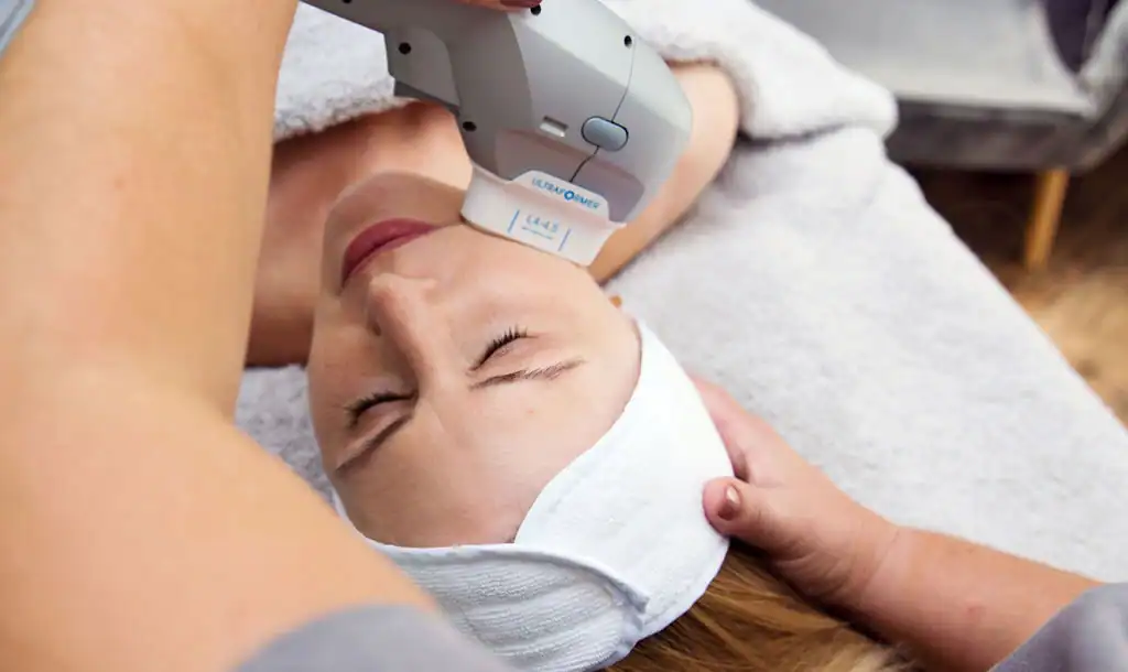 Discover the Perfect Duo: Morpheus8 and HIFU 1 Image of Morpheus8 And HIFU Wickford combined treatment